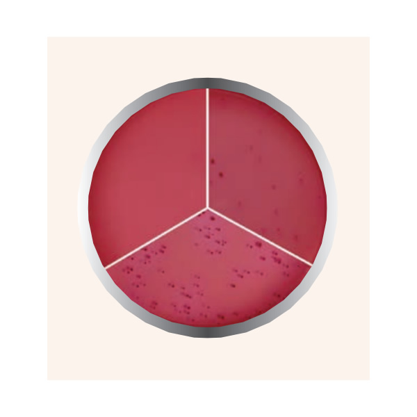 AGAR BILIS ROJO VIOLETA 450G