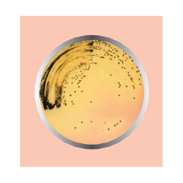 AGAR SAMONELLA Y SHIGELLA 450G